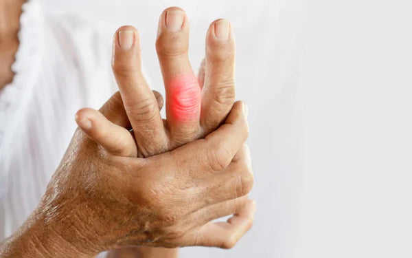 How Joint Health Supplements May Support Arthritis Relief